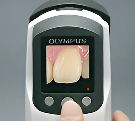 CAPT+（キャプトプラス）